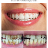 قلم تبييض الأسنان الأمريكي الأصلي  Dazzling White Hollywood smile