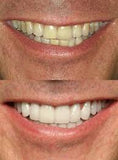 قلم تبييض الأسنان الأمريكي الأصلي  Dazzling White Hollywood smile